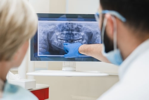 Replacement Veneers in London