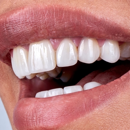 Cosmetic dentistry London